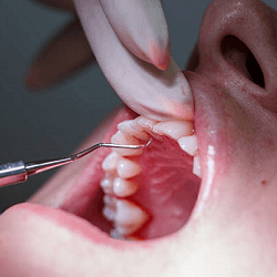 Periodontia